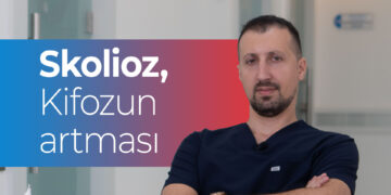Uşaqlarda onurğa problemləri Skolioz və kifozun artması